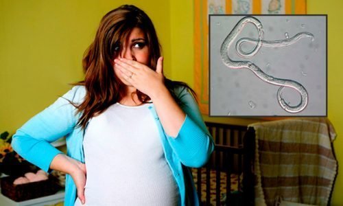 Чем опасны глисты во время беременности и как от них избавиться