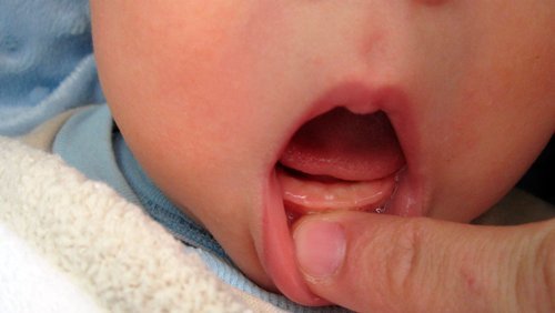 Прорезывание зубов у малыша
